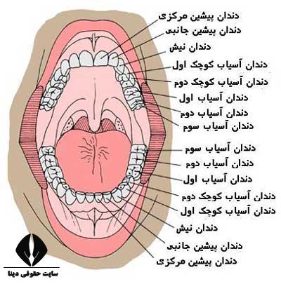 دیه از بین رفتن دندان